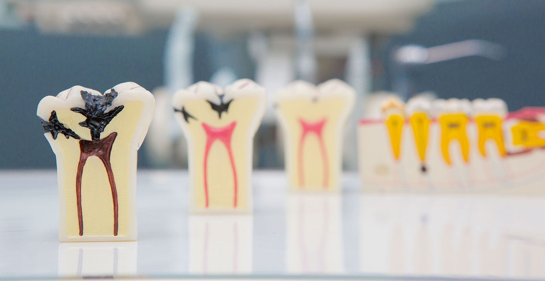 Endodonti